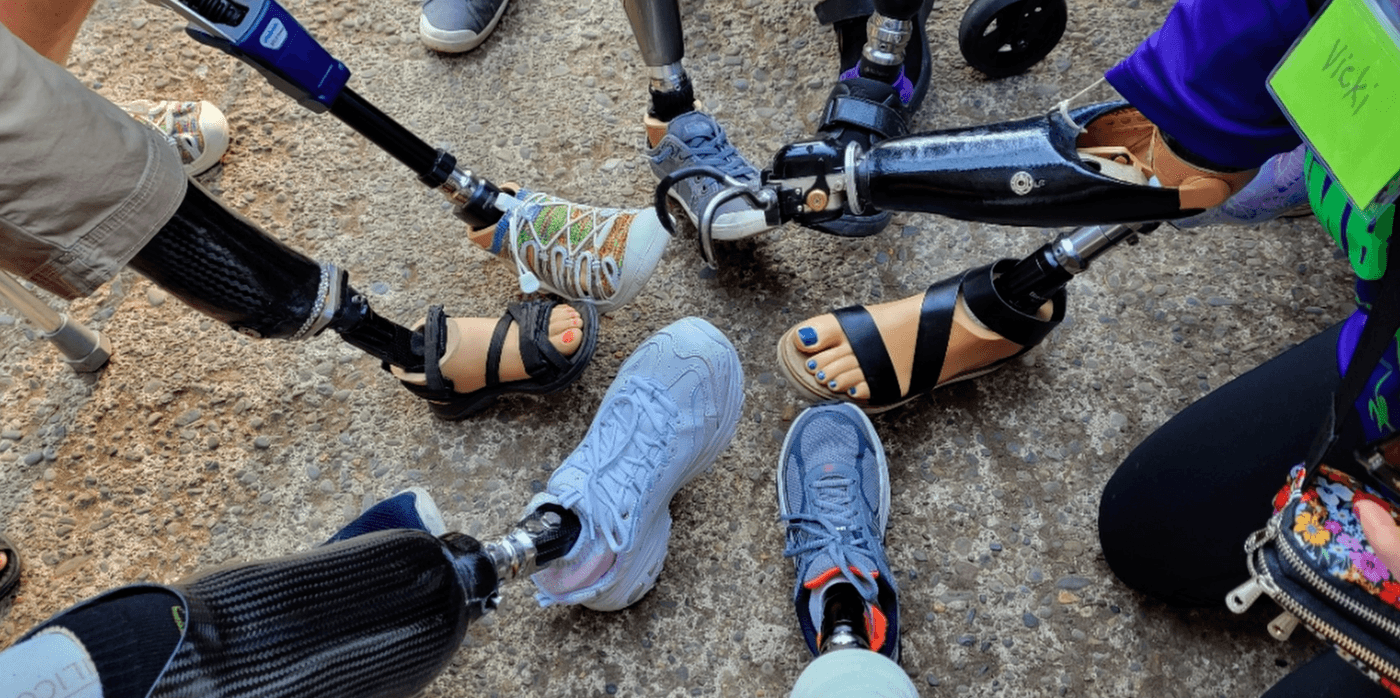 A group of people standing in a circle show off their various prosthetic legs, feet, and a prosthetic arm, all coming together on a paved surface.
